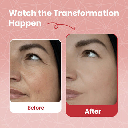 Viareline™ NAD+ Collagen Firming Serum | Buy 1 Get 1 FREE !